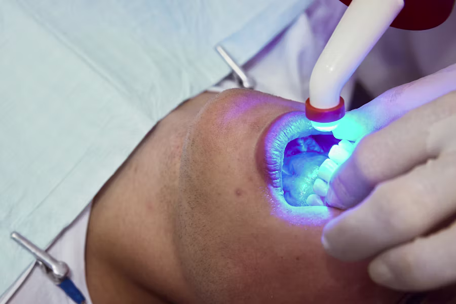 Sbiancamento denti professionale in studio — Studio Dentistico Vecchiotti dr. Marco